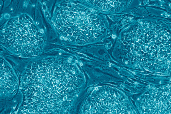 стволовые клетки
