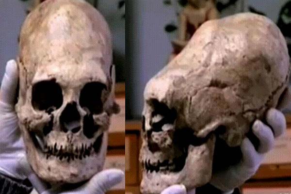 череп, найденный на раскопках